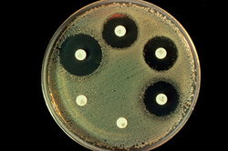Bakterijų atsparumas antibiotikams